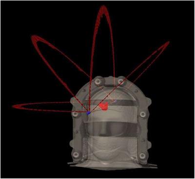 Impact of MRI resolution for Linac-based stereotactic radiosurgery